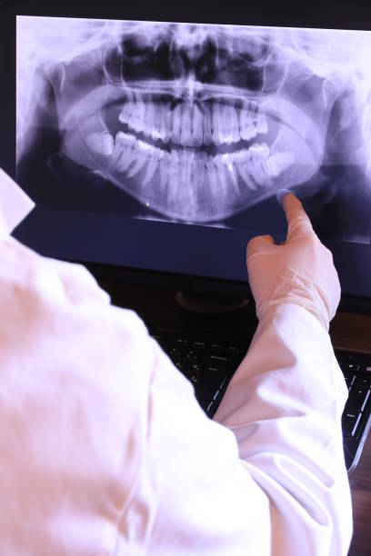Teeth Whitening in GA