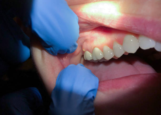 Best Broken Tooth Emergency  in Atlanta, GA